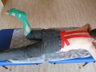 getapter Patient mit Rücken und Achillessehnen Tape